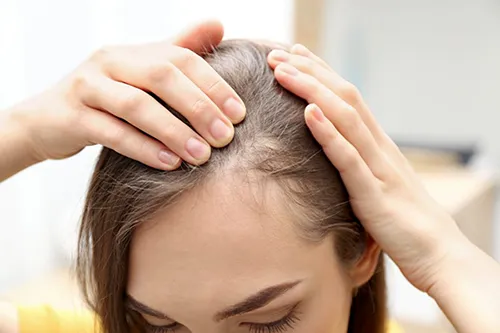 درمان ریزش مو با داروهای گیاهی